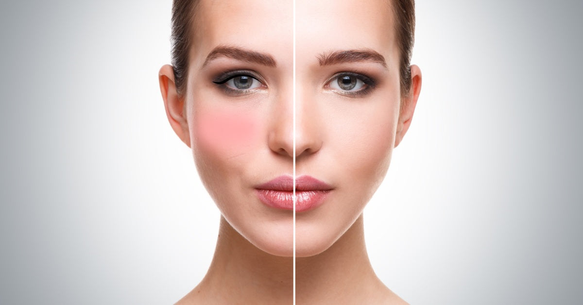 Your Real Skin Filter: Best Skincare Routine for a Natural Glow