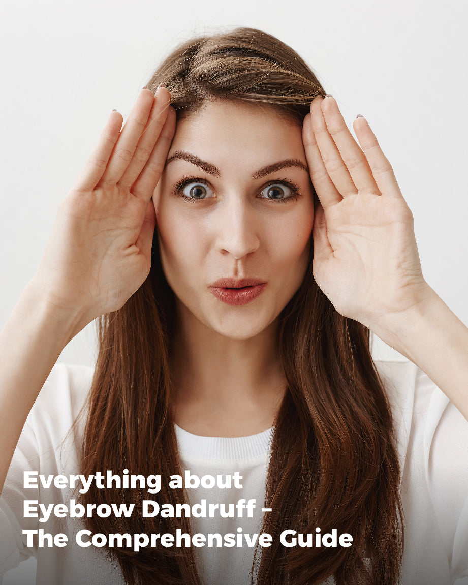 Everything about Eyebrow Dandruff – The Comprehensive Guide