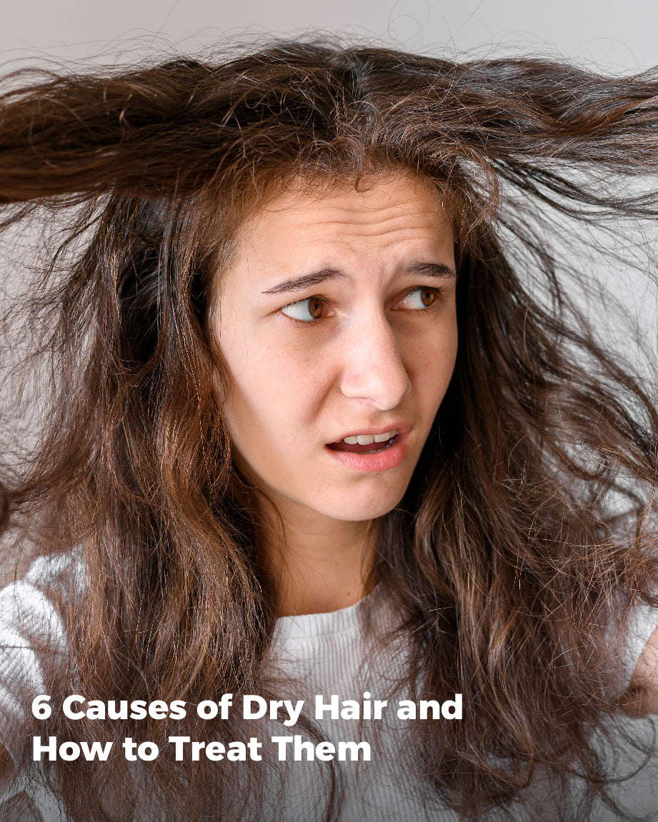 6 Causes of Dry Hair and How to Treat Them